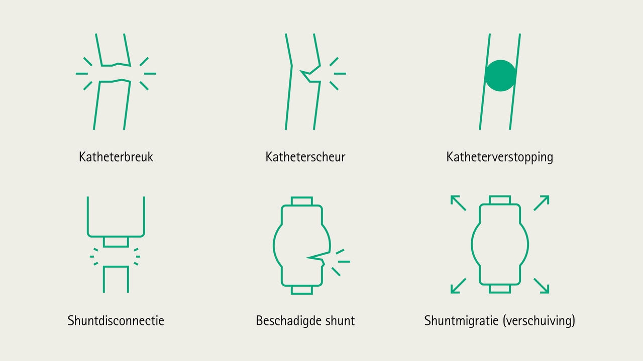 complicaties hydrocephalus shutns iconen